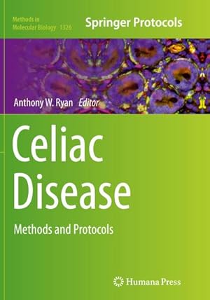 Seller image for Celiac Disease for sale by BuchWeltWeit Ludwig Meier e.K.