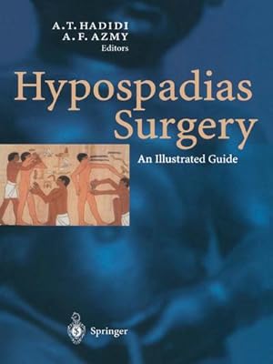 Image du vendeur pour Hypospadias Surgery mis en vente par BuchWeltWeit Ludwig Meier e.K.