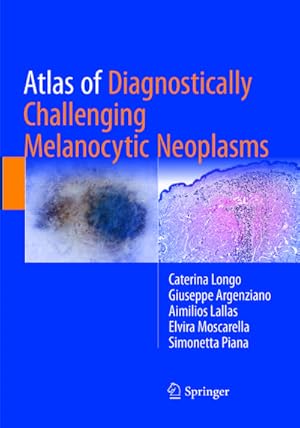 Immagine del venditore per Atlas of Diagnostically Challenging Melanocytic Neoplasms venduto da BuchWeltWeit Ludwig Meier e.K.