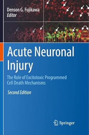 Immagine del venditore per Acute Neuronal Injury venduto da BuchWeltWeit Ludwig Meier e.K.