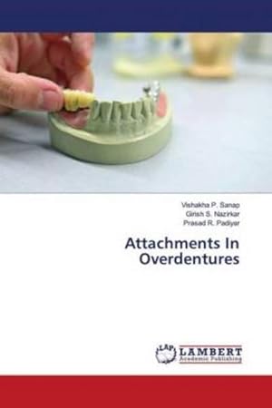 Seller image for Attachments In Overdentures for sale by BuchWeltWeit Ludwig Meier e.K.