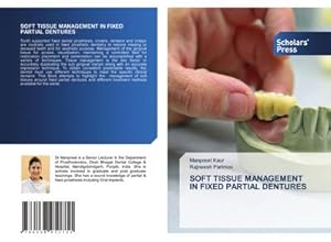 Seller image for SOFT TISSUE MANAGEMENT IN FIXED PARTIAL DENTURES for sale by BuchWeltWeit Ludwig Meier e.K.