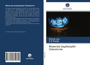 Seller image for Bilaterale Sagittalsplitt-Osteotomie for sale by BuchWeltWeit Ludwig Meier e.K.