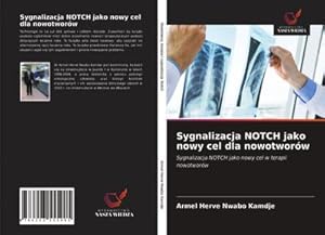 Seller image for Sygnalizacja NOTCH jako nowy cel dla nowotworw for sale by BuchWeltWeit Ludwig Meier e.K.