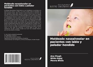 Seller image for Moldeado nasoalveolar en pacientes con labio y paladar hendido for sale by BuchWeltWeit Ludwig Meier e.K.