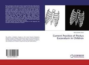 Seller image for Current Practice of Pectus Excavatum in Children for sale by BuchWeltWeit Ludwig Meier e.K.
