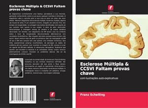 Seller image for Esclerose Mltipla & CCSVI Faltam provas chave for sale by BuchWeltWeit Ludwig Meier e.K.