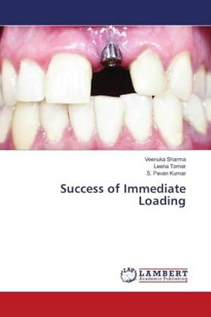 Imagen del vendedor de Success of Immediate Loading a la venta por BuchWeltWeit Ludwig Meier e.K.