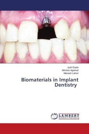 Imagen del vendedor de Biomaterials in Implant Dentistry a la venta por BuchWeltWeit Ludwig Meier e.K.