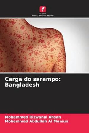 Seller image for Carga do sarampo: Bangladesh for sale by BuchWeltWeit Ludwig Meier e.K.