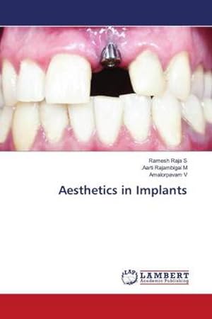 Immagine del venditore per Aesthetics in Implants venduto da BuchWeltWeit Ludwig Meier e.K.
