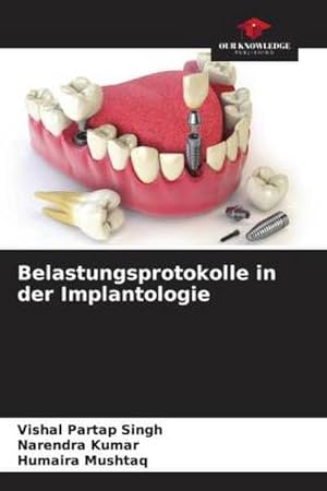 Seller image for Belastungsprotokolle in der Implantologie for sale by BuchWeltWeit Ludwig Meier e.K.