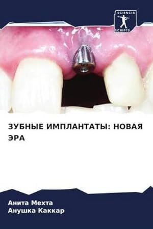 Imagen del vendedor de ZUBNYE IMPLANTATY: NOVAYa JeRA a la venta por BuchWeltWeit Ludwig Meier e.K.