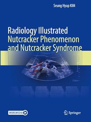 Immagine del venditore per Radiology Illustrated: Nutcracker Phenomenon and Nutcracker Syndrome venduto da BuchWeltWeit Ludwig Meier e.K.