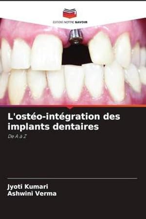 Seller image for L'osto-intgration des implants dentaires for sale by BuchWeltWeit Ludwig Meier e.K.