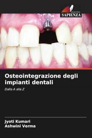 Seller image for Osteointegrazione degli impianti dentali for sale by BuchWeltWeit Ludwig Meier e.K.