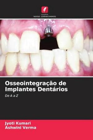 Seller image for Osseointegrao de Implantes Dentrios for sale by BuchWeltWeit Ludwig Meier e.K.