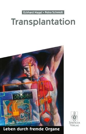 Seller image for Transplantation for sale by BuchWeltWeit Ludwig Meier e.K.