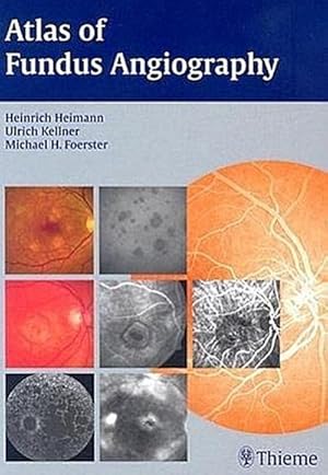 Bild des Verkufers fr Atlas of Fundus Angiography zum Verkauf von AHA-BUCH