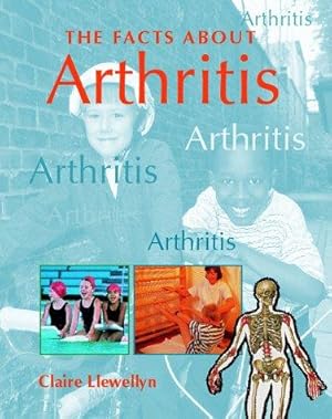 Bild des Verkufers fr FACTS ABOUT ARTHRITIS zum Verkauf von WeBuyBooks