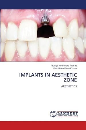 Seller image for IMPLANTS IN AESTHETIC ZONE for sale by moluna