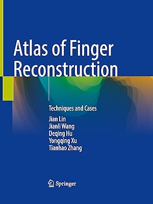 Imagen del vendedor de Atlas of Finger Reconstruction a la venta por moluna