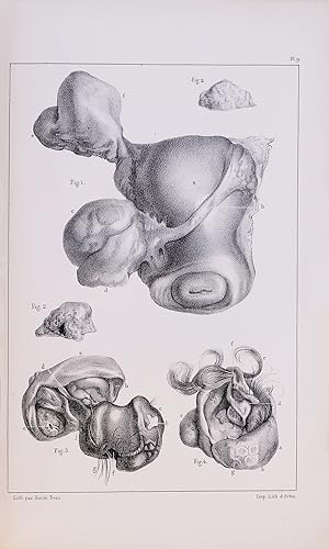 Image du vendeur pour Recherches anatomiques et physiologiques sur les ovaires dans l'espce humaine, considrs spcialement sous le rapport de leur influence dans la menstruation [with] Recueil de faits pour servir  l'histoire des ovaires et des affections hystriques de la femme mis en vente par Le Zograscope