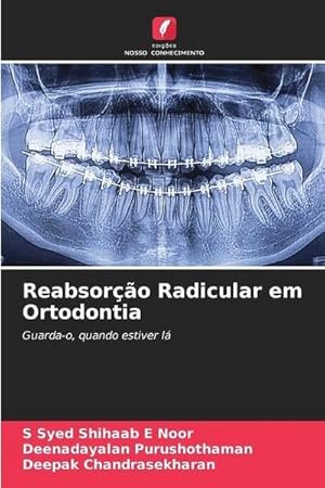 Seller image for Reabsoro Radicular em Ortodontia : Guarda-o, quando estiver l for sale by AHA-BUCH GmbH