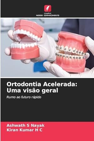 Seller image for Ortodontia Acelerada: Uma viso geral for sale by moluna