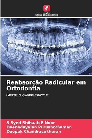 Seller image for Reabsoro Radicular em Ortodontia for sale by BuchWeltWeit Ludwig Meier e.K.