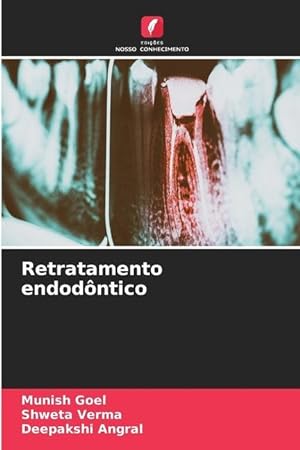 Bild des Verkufers fr Retratamento endodntico zum Verkauf von moluna