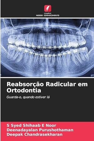 Seller image for Reabsoro Radicular em Ortodontia for sale by moluna