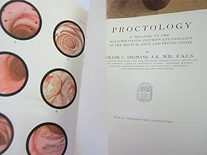 Proctology A Treatise On The Malformations, Injuries And Diseases Of The Rectum, Anus And Pelvic ...