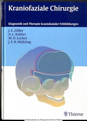 Seller image for Kraniofaziale Chirurgie : Diagnostik und Therapie kraniofazialer Fehlbildungen ; 16 Tabellen for sale by Dennis Wolter