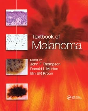Seller image for Textbook of Melanoma for sale by GreatBookPricesUK