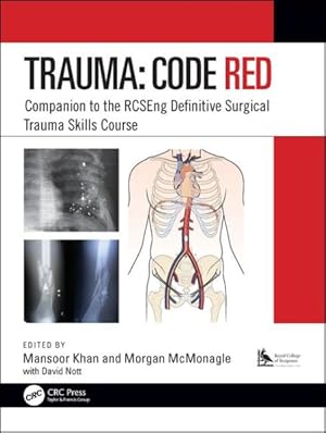 Imagen del vendedor de Trauma : Code Red Companion to the RCSEng Definitive Surgical Trauma Skills Course a la venta por GreatBookPricesUK