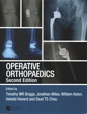 Seller image for Operative Orthopaedics : The Stanmore Guide for sale by GreatBookPricesUK