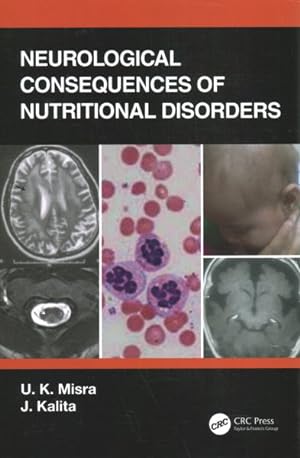 Seller image for Neurological Consequences of Nutritional Disorders for sale by GreatBookPricesUK