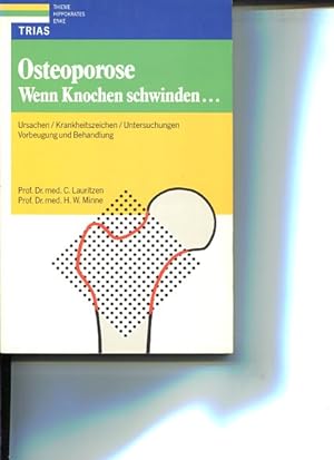 Seller image for Osteoporose. wenn Knochen schwinden ; Ursachen, Krankheitszeichen, Untersuchungen, Vorbeugung und Behandlung. for sale by Antiquariat Buchkauz