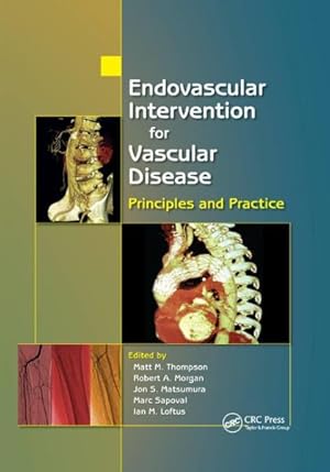 Seller image for Endovascular Intervention for Vascular Disease : Principles and Practice for sale by GreatBookPricesUK