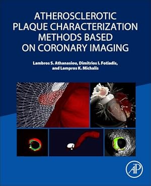 Immagine del venditore per Atherosclerotic Plaque Characterization Methods Based on Coronary Imaging venduto da GreatBookPrices