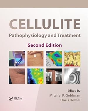 Immagine del venditore per Cellulite : Pathophysiology and Treatment venduto da GreatBookPrices
