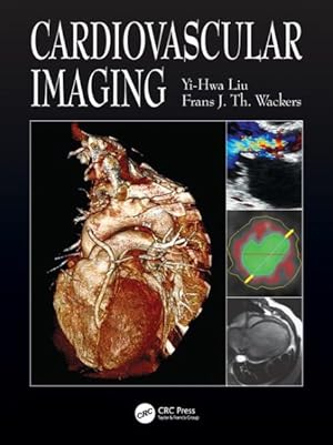 Seller image for Cardiovascular Imaging for sale by GreatBookPrices