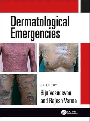 Seller image for Dermatological Emergencies for sale by GreatBookPrices