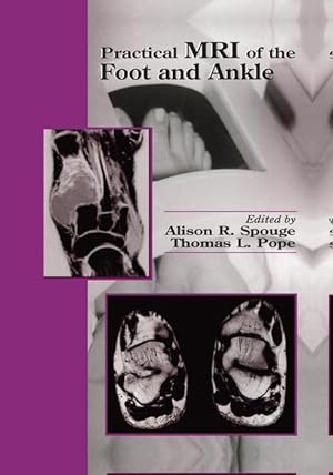 Seller image for Practical MRI of the Foot and Ankle for sale by moluna