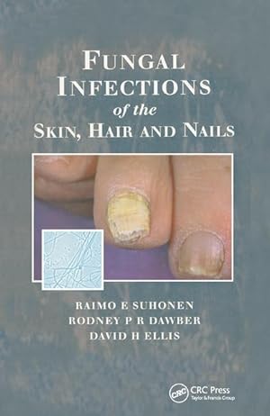 Seller image for Suhonen, R: Fungal Infections of the Skin and Nails for sale by moluna