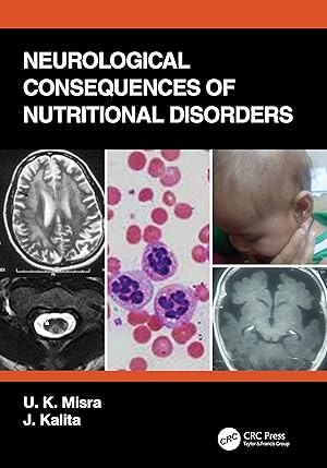 Seller image for Neurological Consequences of Nutritional Disorders for sale by moluna