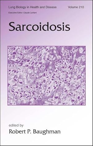 Immagine del venditore per Sarcoidosis venduto da moluna