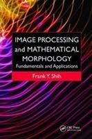Seller image for Shih, F: Image Processing and Mathematical Morphology for sale by moluna