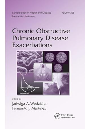 Seller image for Chronic Obstructive Pulmonary Disease Exacerbations for sale by moluna